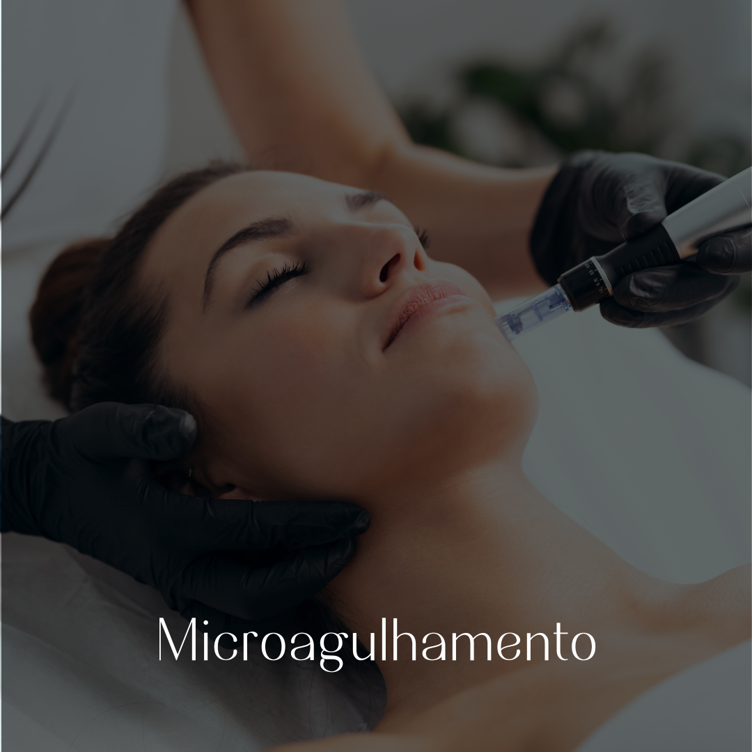 microagulhamento